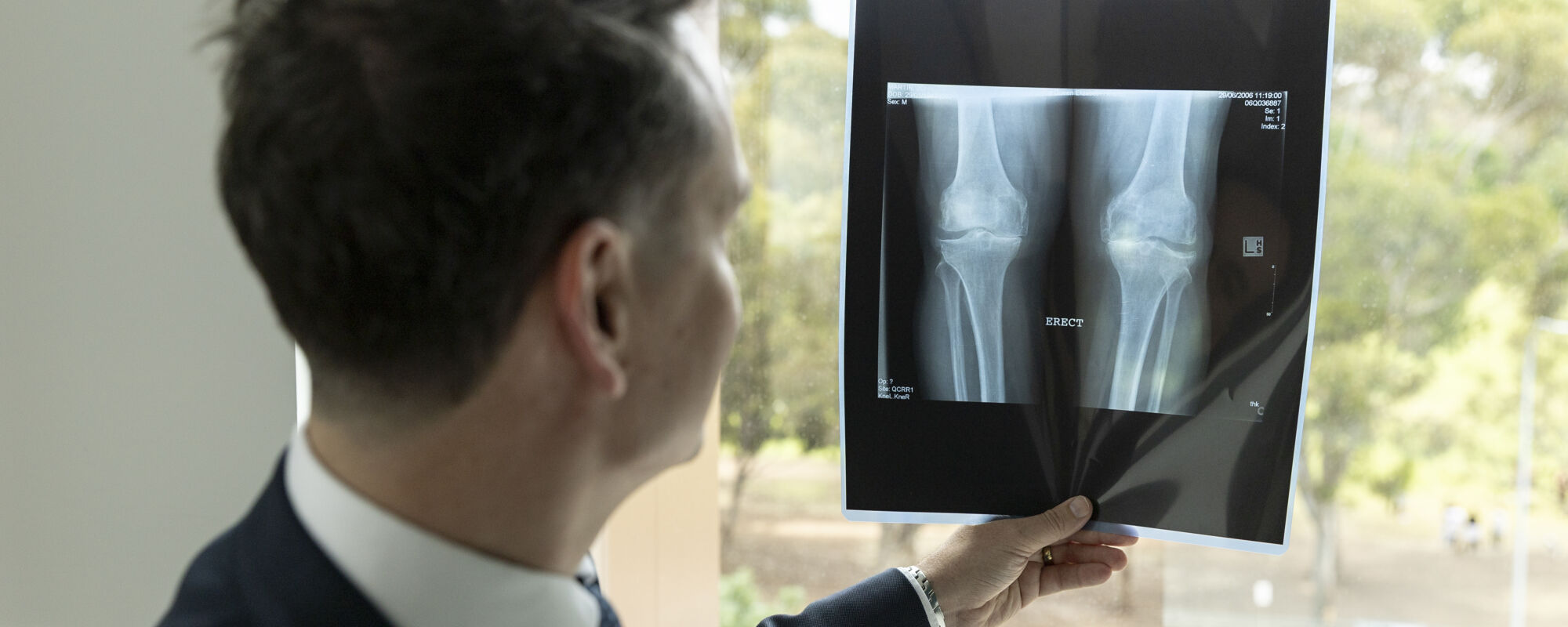 Orthopaedic Surgeon Arthritis knee XR